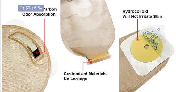 Colostomy Bags Feature