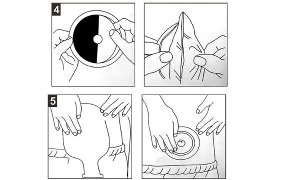 Colostomy Bags Usage (1)