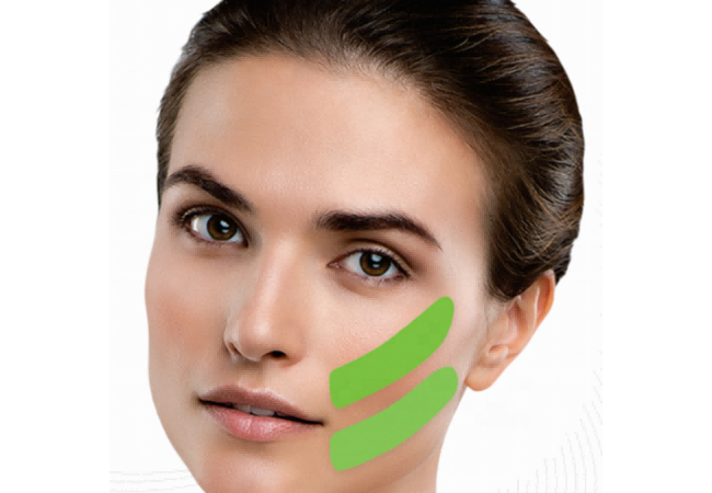Kinesiology Tape (5)(1)