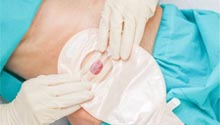 Supporting Your Everyday Ostomy Care mini